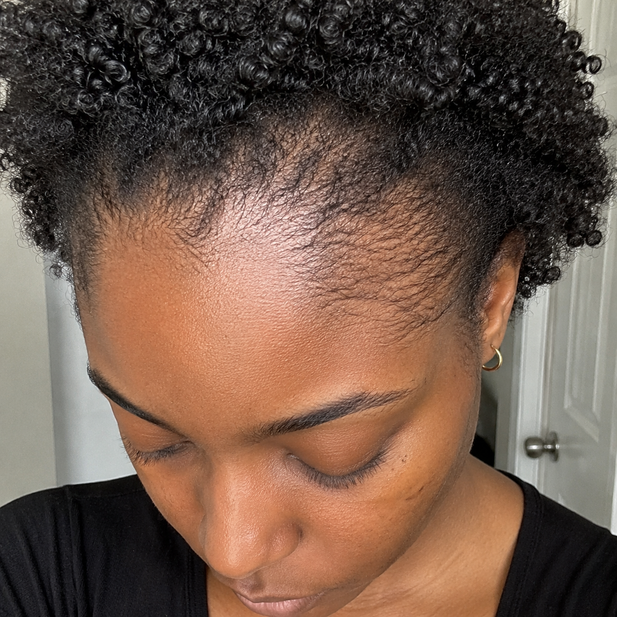 Before - Rachel W.
