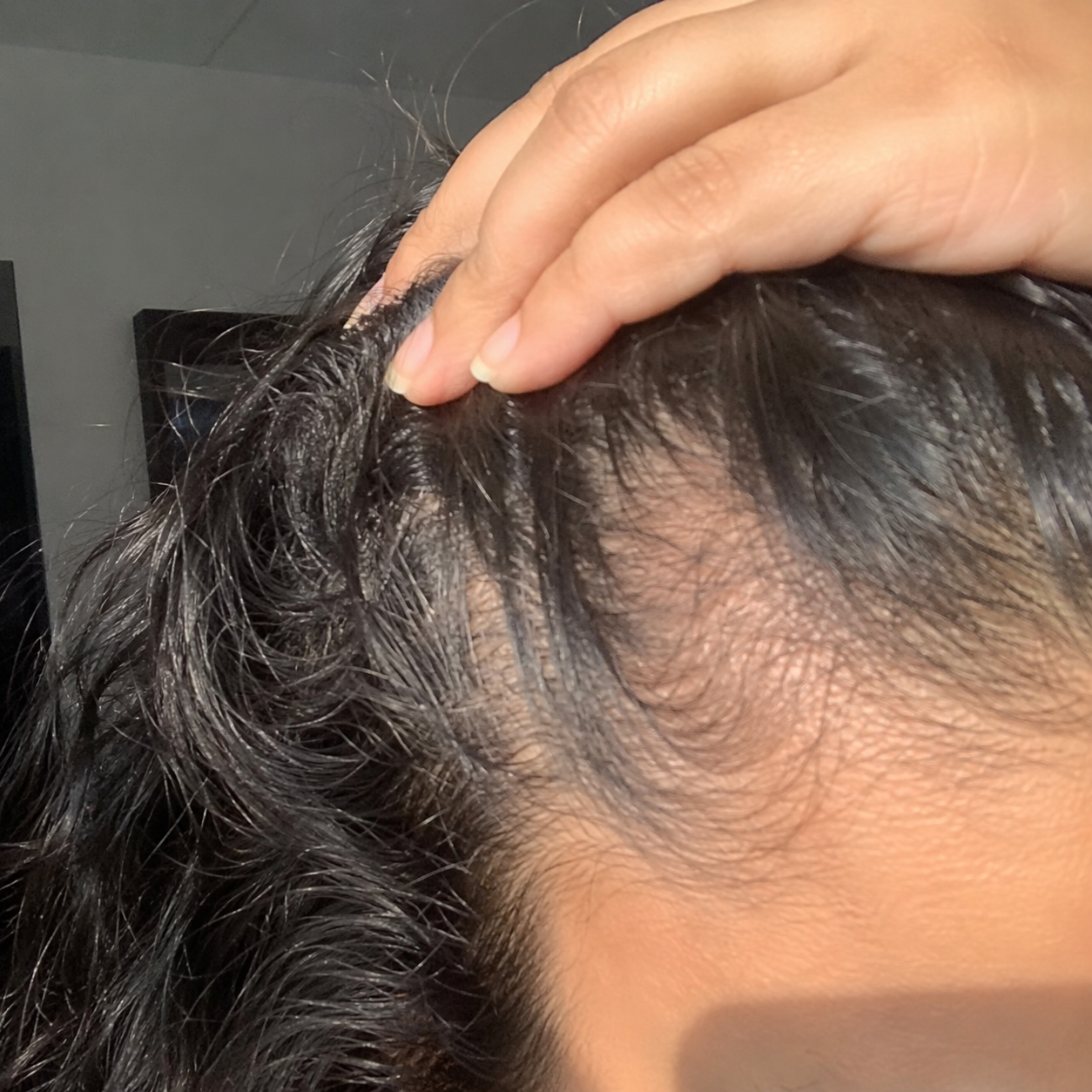 Before - Ashley K.