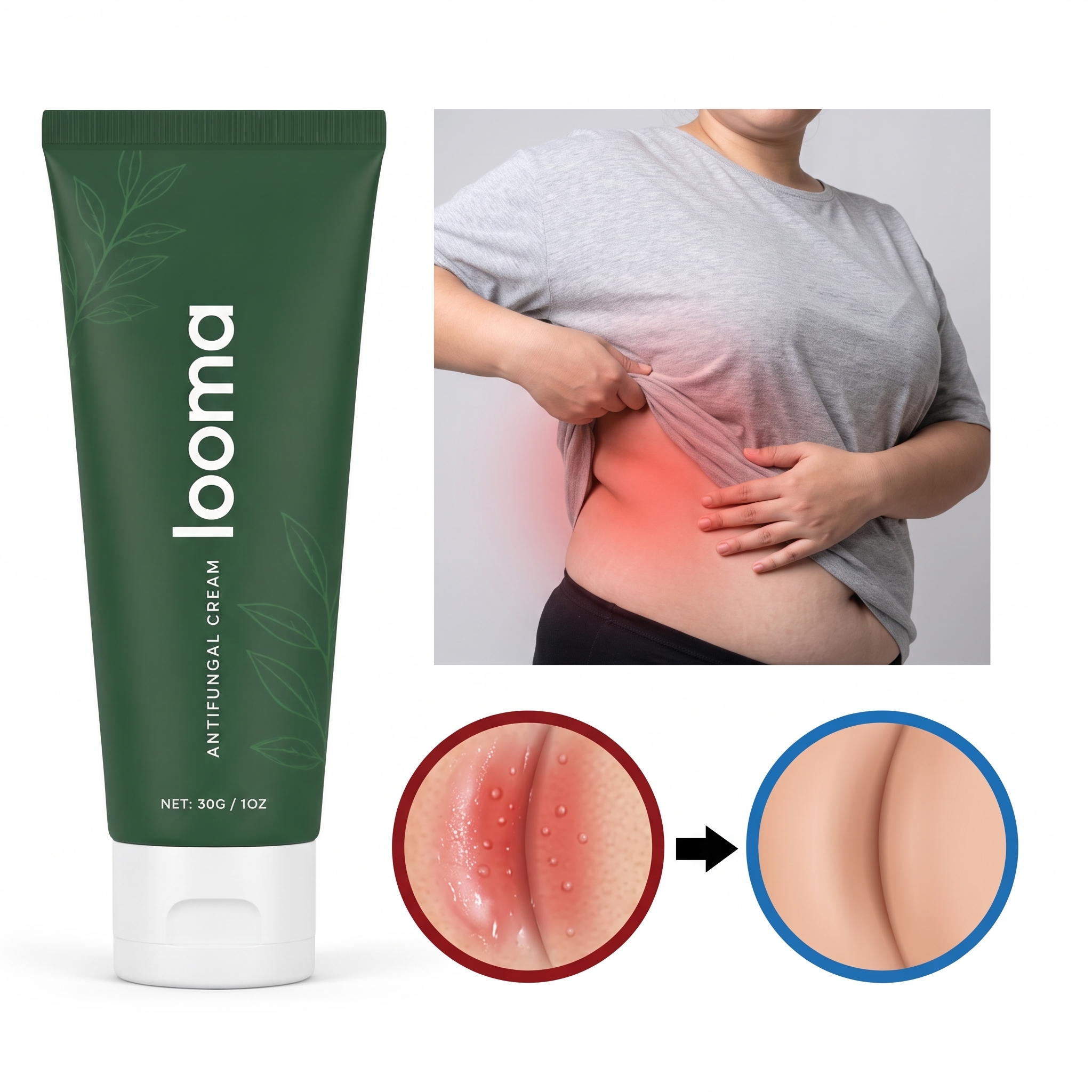 Looma Antifungal Barrier Cream — before and after skin fold relief
